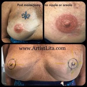 3d double mastectomy areola scar coverup tattoo