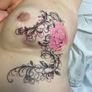 Mastectomy art