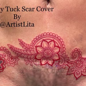 Tummy tuck scar cover up