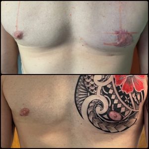 Male Scar cover up