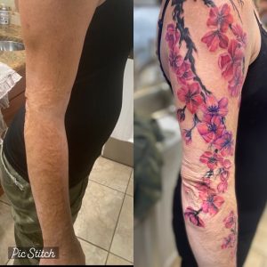 Burn scar cover up