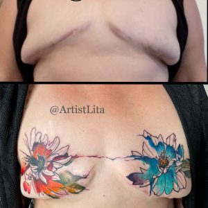 P.Ink Day Double Mastectomy Scar Coverup Floral Tattoo
