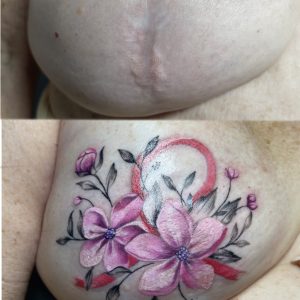 Single Mastectomy Art Scar Coverup Tattoo