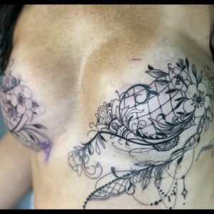 Double Mastectomy Lace Bra Scar Coverup Tattoo