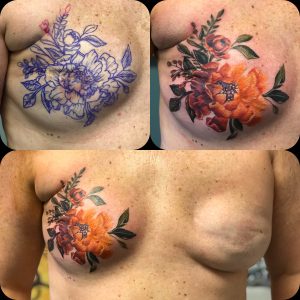 Double Mastectomy Floral Artwork